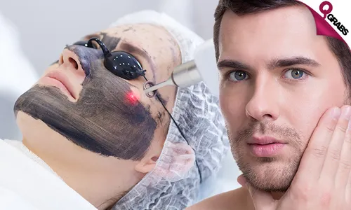 Carbon Laser for Face, Hair & Dark Areas!